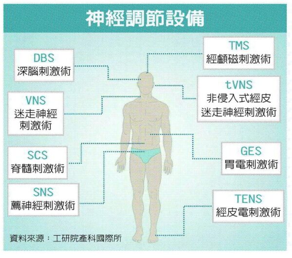 神經調控治療